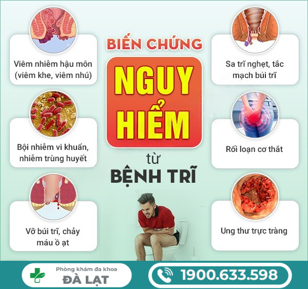 Hình ảnh minh họa